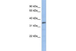 WB Suggested Anti-MYF5 Antibody   Titration: 1 ug/ml   Positive Control: Human Jurkat Cell (MYF5 anticorps  (N-Term))