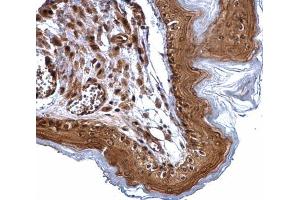 IHC-P Image ERCC2 antibody [N2C2], Internal detects ERCC2 protein at cytosol and nucleus on mouse esophagus by immunohistochemical analysis. (ERCC2 anticorps  (Internal Region))