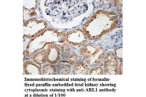Image no. 1 for anti-ADP Ribosylation Factor Like GTPase 1 (ARL1) antibody (ABIN1574817) (ARL1 anticorps)