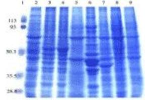 SDS-PAGE (SDS) image for Rat Normal Tissue Blot II (ABIN2455975) (Rat Normal Tissue Blot II)
