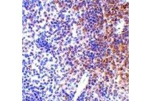Immunohistochemistry (IHC) image for anti-Interferon Regulatory Factor 7 (IRF7) (Middle Region) antibody (ABIN1030964) (IRF7 anticorps  (Middle Region))