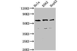 Western Blot Positive WB detected in: Hela whole cell lysate, K562 whole cell lysate, HepG2 whole cell lysate All lanes: CCT5 antibody at 4 μg/mL Secondary Goat polyclonal to rabbit IgG at 1/50000 dilution Predicted band size: 60, 50 kDa Observed band size: 60 kDa (CCT5 anticorps  (AA 1-270))