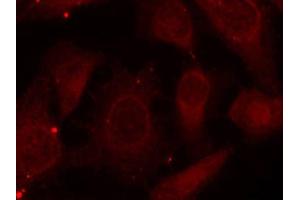 Immunofluorescence staining of methanol-fixed HeLa cells using Phospho-NF2-S518 antibody (ABIN2988202). (Merlin anticorps  (pSer518))