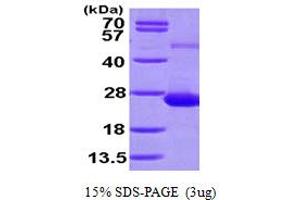 SDS-PAGE (SDS) image for Adenosine Deaminase, tRNA-Specific 2 (ADAT2) (AA 1-191) protein (His tag) (ABIN667820)