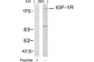 Image no. 3 for anti-Insulin-Like Growth Factor 1 Receptor (IGF1R) (Tyr1161) antibody (ABIN197243) (IGF1R anticorps  (Tyr1161))