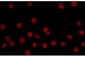 ABIN6266705 staining HuvEc by IF/ICC. (ANP32C anticorps  (Internal Region))