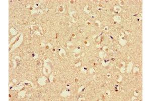 Immunohistochemistry of paraffin-embedded human brain tissue using ABIN7170721 at dilution of 1:100