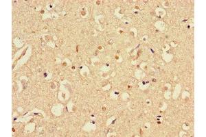 Immunohistochemistry of paraffin-embedded human brain tissue using ABIN7170721 at dilution of 1:100 (Stathmin 1 anticorps  (AA 13-78))