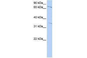 WB Suggested Anti-ZNF224 Antibody Titration:  0. (ZNF224 anticorps  (Middle Region))