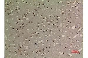 Immunohistochemistry (IHC) analysis of paraffin-embedded Human Brain, antibody was diluted at 1:100.