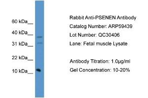 WB Suggested Anti-PSENEN  Antibody Titration: 0. (PEN2 anticorps  (C-Term))