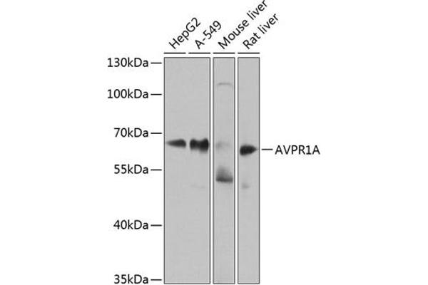 AVPR1A Antikörper  (AA 349-418)