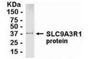 Western Blotting (WB) image for anti-Solute Carrier Family 9, Subfamily A (NHE3, Cation Proton Antiporter 3), Member 3 Regulator 1 (SLC9A3R1) (AA 240-358) antibody (ABIN2468021) (SLC9A3R1 anticorps  (AA 240-358))