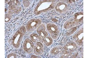 IHC-P Image MCCC2 antibody [N1C1] detects MCCC2 protein at mitochondria in mouse cervix by immunohistochemical analysis.