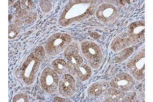 IHC-P Image MCCC2 antibody [N1C1] detects MCCC2 protein at mitochondria in mouse cervix by immunohistochemical analysis. (MCCC2 anticorps  (Center))
