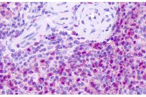 Anti-Neurokinin 1 Receptor / NK1R antibody IHC staining of human spleen.