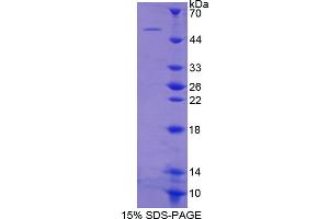 Image no. 1 for Nexilin (NEXN) (AA 421-607) protein (His tag,GST tag) (ABIN4990708) (NEXN Protein (AA 421-607) (His tag,GST tag))