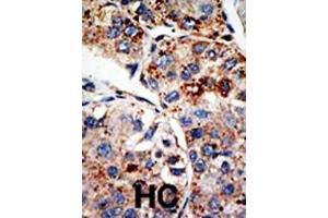 anti-DOT1-Like, Histone H3 Methyltransferase (S. Cerevisiae) (DOT1L) (AA 1390-1420), (C-Term) antibody