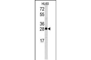 Western blot analysis of Latexin Antibody in HL60 cell line lysates (35ug/lane) (Latexin anticorps  (N-Term))