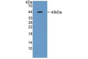 Detection of Recombinant AST, Rat using Polyclonal Antibody to Aspartate Aminotransferase (AST) (GOT1 anticorps  (AA 1-413))