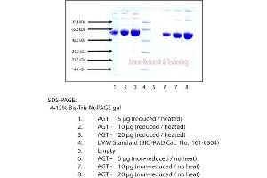 Gel Scan of Angiotensinogen, Human Plasma  This information is representative of the product ART prepares, but is not lot specific.