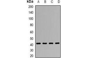 Western blot analysis of Clusterin expression in HepG2 (A), SW480 (B), Hela (C), mouse liver (D) whole cell lysates. (Clusterin anticorps)