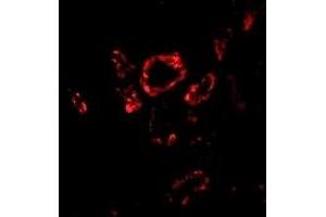 Immunofluorescence (IF) image for anti-SLUG (Middle Region 2) antibody (ABIN1031203) (SLUG anticorps  (Middle Region 2))