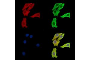 ABIN7095943 and ABIN7100005 staining Hela cells by IF/ICC. (EPM2AIP1 anticorps)