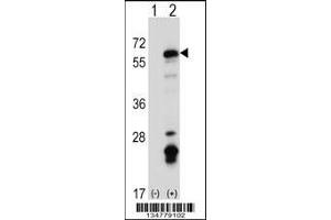 Western blot analysis of Fyn using rabbit polyclonal Mouse Fyn Antibody using 293 cell lysates (2 ug/lane) either nontransfected (Lane 1) or transiently transfected (Lane 2) with the Fyn gene.