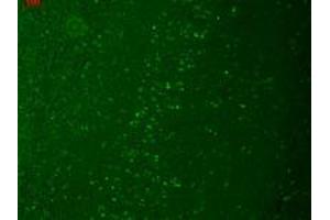 TrpM7 (S74 25), Human hippocampus.