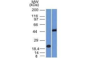 Western Blot Analysis (A) Recombinant Protein (B) Raji cell lysate Using PAX8 Mouse Monoclonal Antibody (PAX8/1492). (PAX8 anticorps  (AA 60-261))