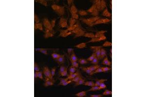Immunofluorescence analysis of C6 cells using DDX3X antibody (ABIN6130252, ABIN6139494, ABIN6139495 and ABIN6221274) at dilution of 1:100.