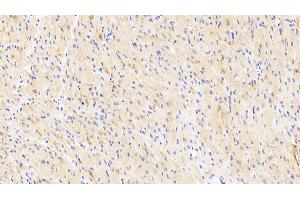 Detection of NOVA1 in Human Cardiac Muscle Tissue using Polyclonal Antibody to Neuro Oncological Ventral Antigen 1 (NOVA1)