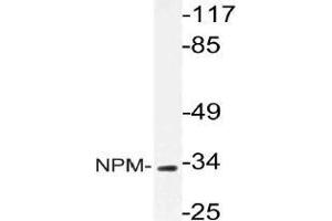 Western blot (WB) analysis of NPM antibody in extracts from HeLa cells. (NPM1 anticorps)