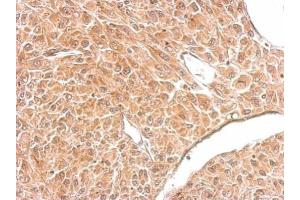 IHC-P Image Amphiphysin antibody [N1N2], N-term detects AMPH protein at cytosol on U87 xenograft by immunohistochemical analysis. (Amphiphysin anticorps  (N-Term))