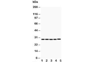 Western blot testing of CD40L antibody and Lane 1:  MCF-7;  2: HeLa;  3: Jurkat;  4: HMY2;  5: COLO320;  Predicted size: 29KD;  Observed size: 29KD (CD40 Ligand anticorps  (N-Term))