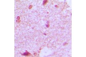 Immunohistochemical analysis of ZHX2 staining in human brain formalin fixed paraffin embedded tissue section.