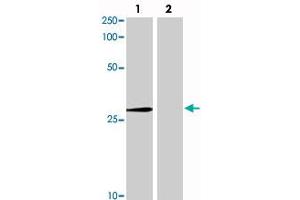 Western blot analysis in Lane 1: 293 cells transfected with Abcc10 and Lane 2: 293 cells transfected withoud Abcc10 with Abcc10 monoclonal antibody, clone C1. (ABCC10 anticorps  (AA 890-894))