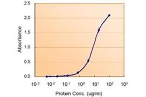 Image no. 3 for anti-Glucose-6-Phosphate Dehydrogenase (G6PD) (AA 308-320), (Internal Region) antibody (ABIN374790) (Glucose-6-Phosphate Dehydrogenase anticorps  (Internal Region))