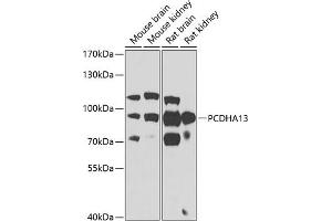 Western blot analysis of extracts of various cell lines, using PCDH antibody (ABIN6129639, ABIN6145299, ABIN6145300 and ABIN6223365) at 1:1000 dilution. (PCDHa13 anticorps  (AA 300-360))