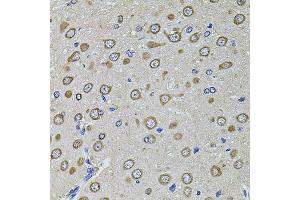 Immunohistochemistry of paraffin-embedded rat brain using EIF4A2 antibody (ABIN2736687) at dilution of 1:100 (40x lens). (EIF4A2 anticorps)