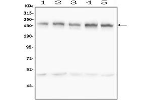 anti-GLI Family Zinc Finger 2 (GLI2) (AA 721-1457) antibody