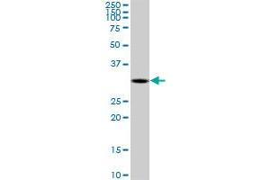 DECR2 monoclonal antibody (M03), clone 4A7.