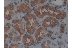 Detection of FTH in Human Kidney Tissue using Polyclonal Antibody to Ferritin, Heavy Polypeptide (FTH)