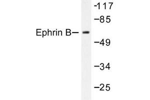 Image no. 1 for anti-Ephrin B1 (EFNB1) antibody (ABIN271886) (Ephrin B1 anticorps)
