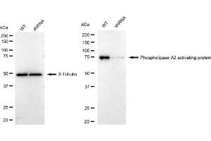 Western blotting analysis using Phospholipase A2 activating protein antibody (ABIN7799820). (Recombinant PLAA anticorps)