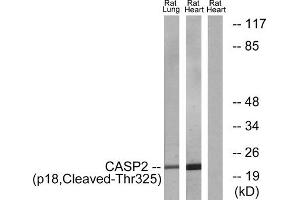 Western blot analysis of extracts from rat lung cells and rat heart cells, using CASP2 (p18, Cleaved-Thr325) antibody. (Caspase 2 anticorps  (Cleaved-Thr325))