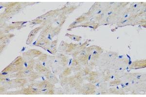 Immunohistochemistry of paraffin-embedded Mouse heart using FGFR2 Polyclonal Antibody at dilution of 1:100 (40x lens). (FGFR2 anticorps)