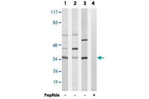Western blot analysis of extracts from A-549 cells (Lane 1), LoVo cells (Lane 2) and K-562 cells (Lane 3 and lane 4), using CA5A polyclonal antibody .