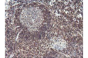 Immunohistochemical staining of paraffin-embedded Human tonsil using anti-PDLIM2 mouse monoclonal antibody. (PDLIM2 anticorps)